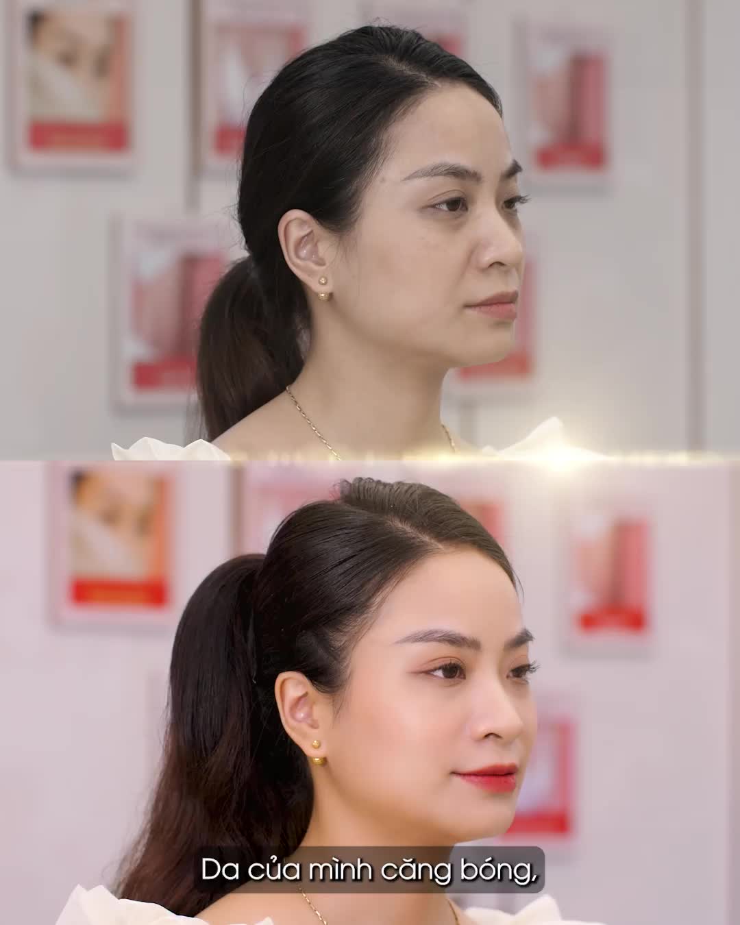 Người thật việc thật - Khách hàng chia sẻ thực tế sau khi Trẻ hóa Mi Young tại Kangnam